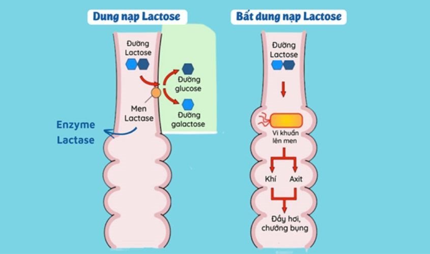 Biểu đồ minh họa cơ chế hoạt động của enzym lactase và tình trạng bất dung nạp lactose ở trẻ nhỏ