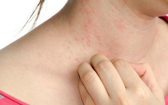 Các tác dụng phụ phổ biến khi sử dụng CoQ10 và cách xử lý