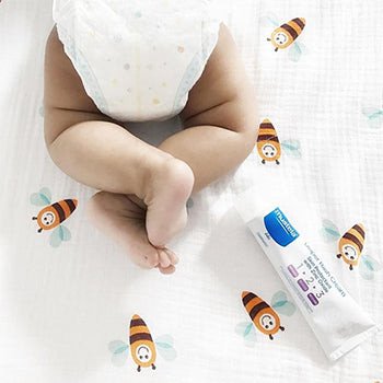 Em bé với kem trị hăm tã