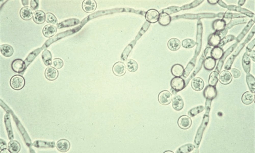Hình ảnh vi khuẩn Candida dưới kính hiển vi, minh họa khả năng hỗ trợ kiểm soát nấm men của viên uống giấm táo.