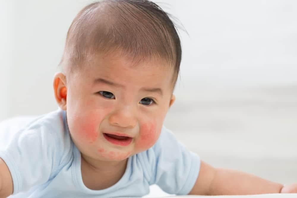 Lựa chọn kem dưỡng ẩm an toàn cho làn da nhạy cảm của trẻ sơ sinh