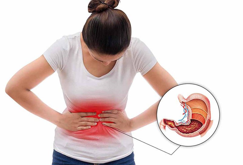Người bệnh biểu hiện đau dạ dày, cảnh báo về các triệu chứng cần điều trị trào ngược bằng thuốc Nexium 40mg, nhấn mạnh việc uống thuốc Nexium 40mg vào lúc nào tốt