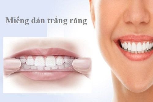 Người đang cười rạng rỡ sau khi sử dụng miếng dán làm trắng răng