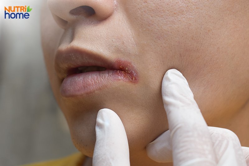 tác dụng của kẽm
