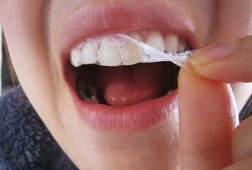 Tác hại của miếng dán làm trắng răng có thể ảnh hưởng đến ngà răng nếu dùng sai cách