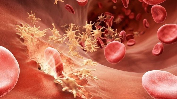 Thận trọng khi sử dụng ibuprofen 200mg cho người có tiền sử rối loạn đông máu