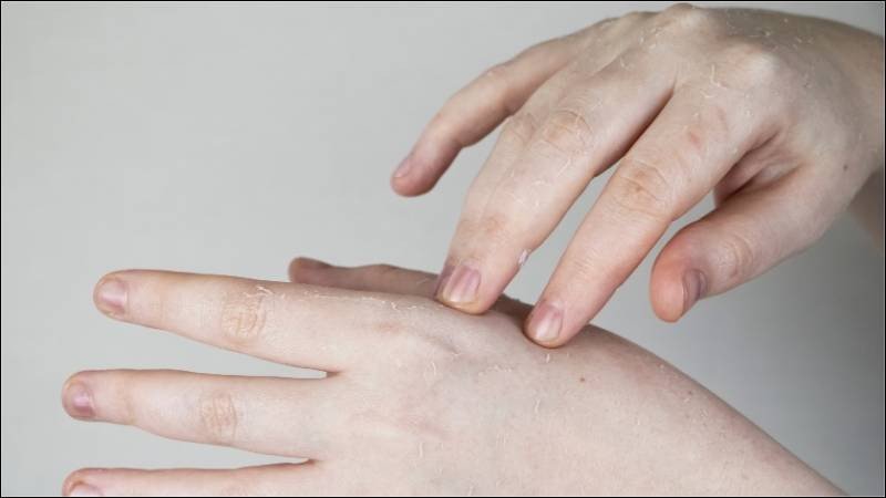 Thoa lanolin cream đúng cách giúp tối ưu hiệu quả dưỡng da tay