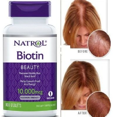 Viên uống Biotin 10000mcg cải thiện tình trạng tóc rụng