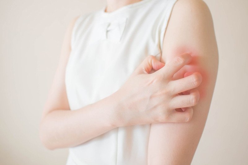 Người bị dị ứng với nấm cần tránh xa dược liệu này